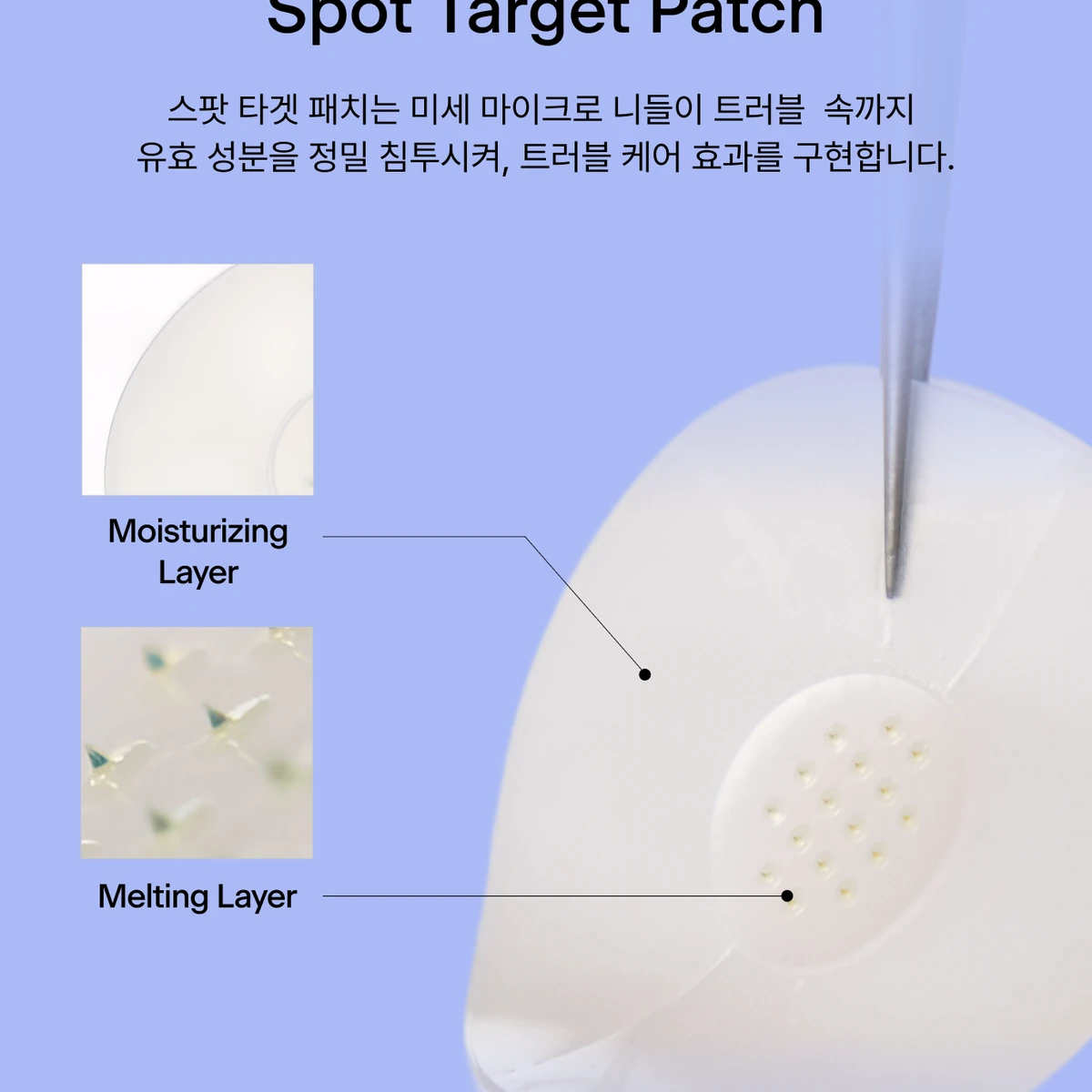 톰 스팟 타겟 패치 (압출 전 관리) 상품 이미지