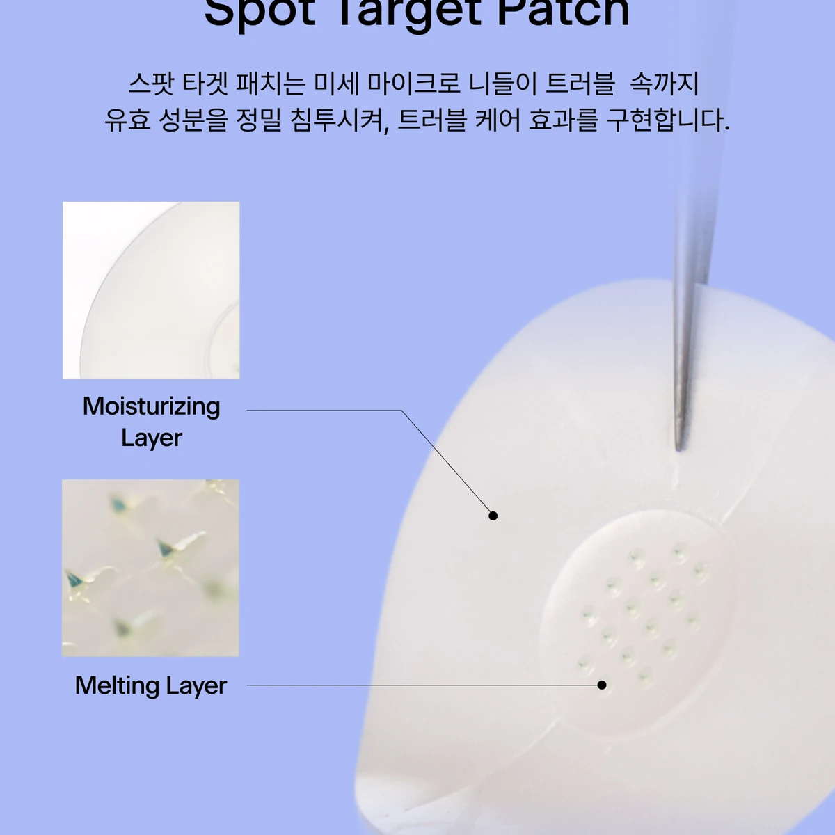 톰 스팟 리페어링 패치 (압출 후 관리) 상품 이미지